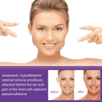 6Pcs Waterproof Ear Patch Transparent Invisible Ear Support Corrector Sticker Personal Health Care - Image 4