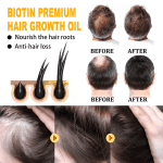 Deals up to 50% Off! Hair Growth Products Biotin Fast-Growing Hair Essential Oil Antihair Loss Serums Skin Care 100Ml Christmas Gifts for Women - Image 8