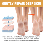 Foot Callus Remover Spray Improve Dryness and Roughness, and Replenish Skin with Moisturing 30Ml, Beauty & Personal Care - Image 4