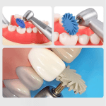 6Pcs/Box RA Coarse Fine Medium Denspay Dental Rubber Polisher Composite Resin Polishing Disc 14Mm Wheel 3 Color Spiral Flex Tool - Image 6