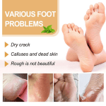 Foot Callus Remover Spray Improve Dryness and Roughness, and Replenish Skin with Moisturing 30Ml, Beauty & Personal Care - Image 8