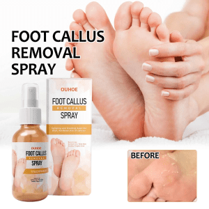 Foot Callus Remover Spray Improve Dryness and Roughness, and Replenish Skin with Moisturing 30Ml, Beauty & Personal Care