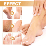 Foot Callus Remover Spray Improve Dryness and Roughness, and Replenish Skin with Moisturing 30Ml, Beauty & Personal Care - Image 9