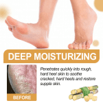 Foot Callus Remover Spray Improve Dryness and Roughness, and Replenish Skin with Moisturing 30Ml, Beauty & Personal Care - Image 5